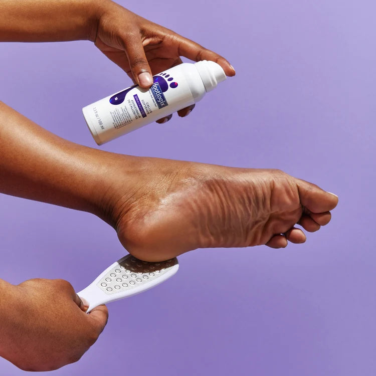 Footlogix Callus Softener en voetvijl voor het verzorgen van eelt op de voeten.