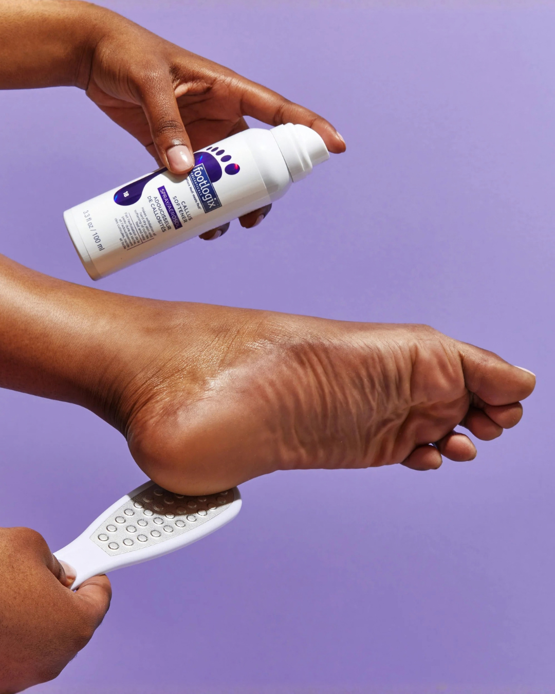 Person applying Footlogix callus remover spray to a foot being exfoliated with a foot file.
